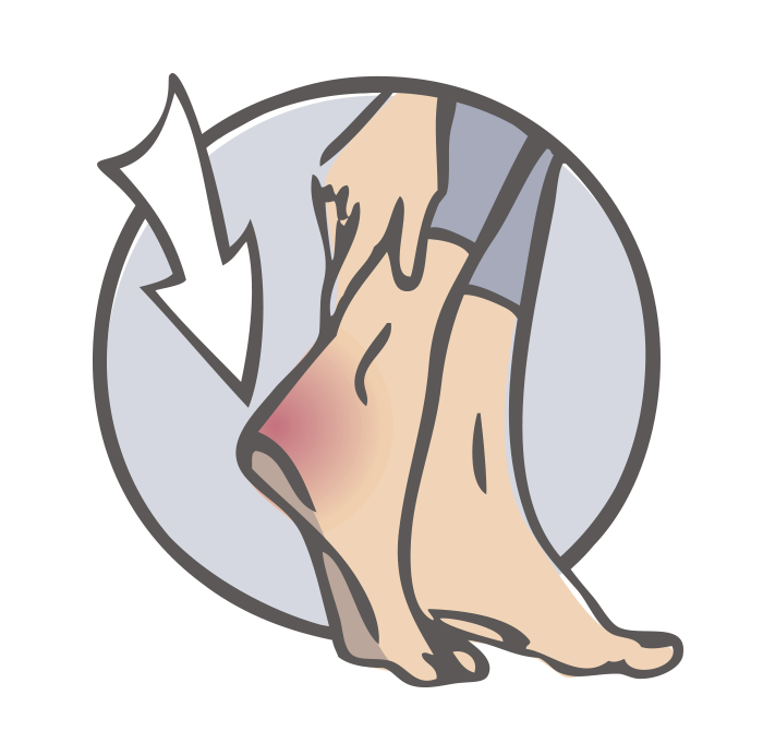 Achilles tendon and heel