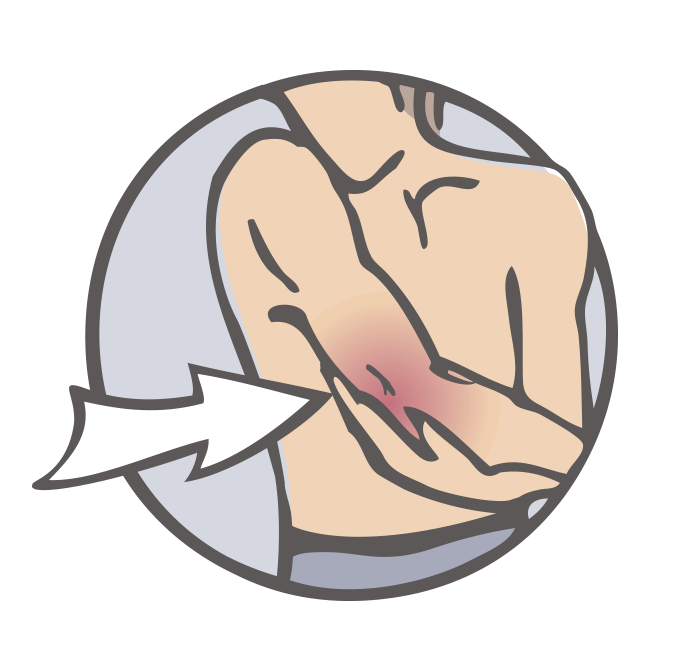 Elbow