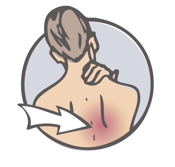 Back and fascia